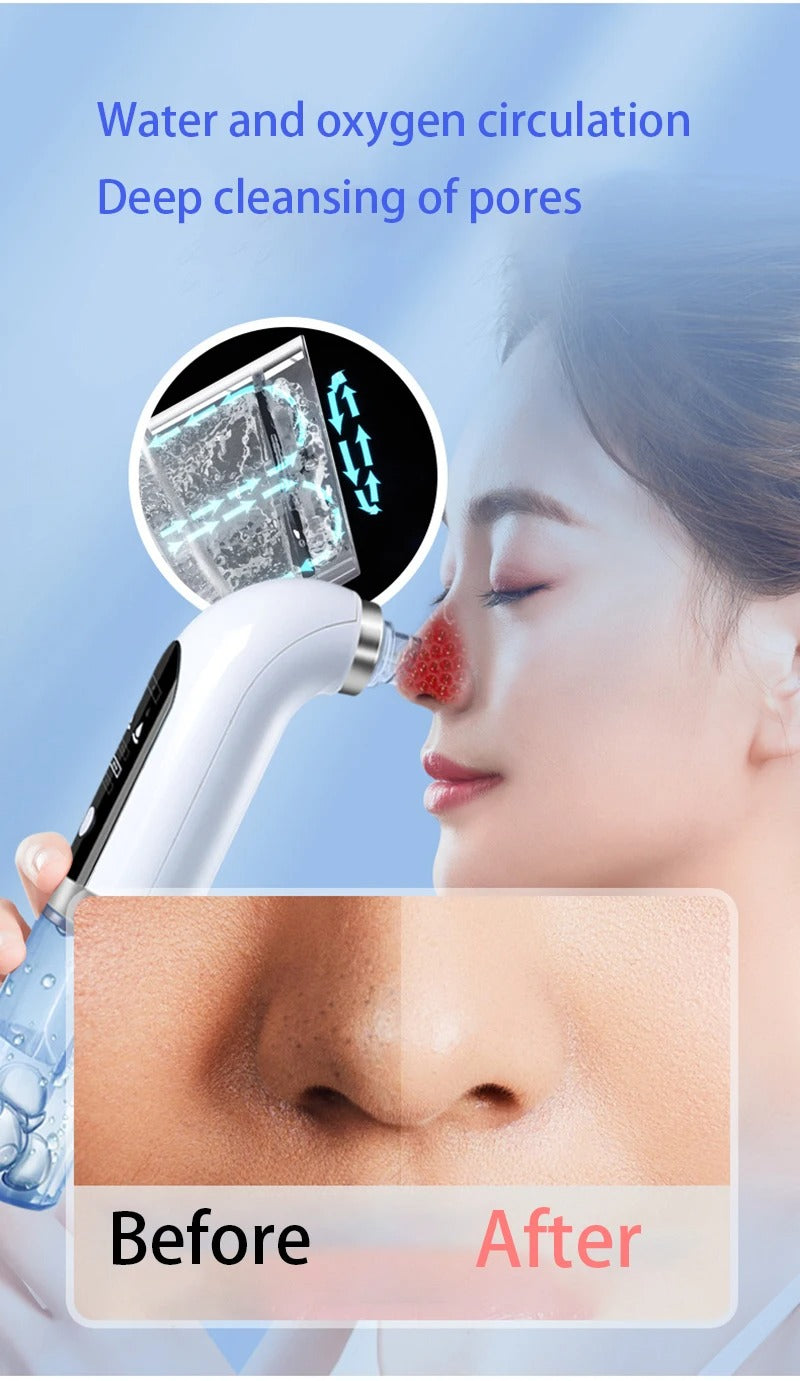 Electric Blackhead Remover Vacuum